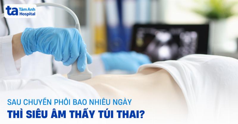 Các mốc quan trọng sau chuyển phôi