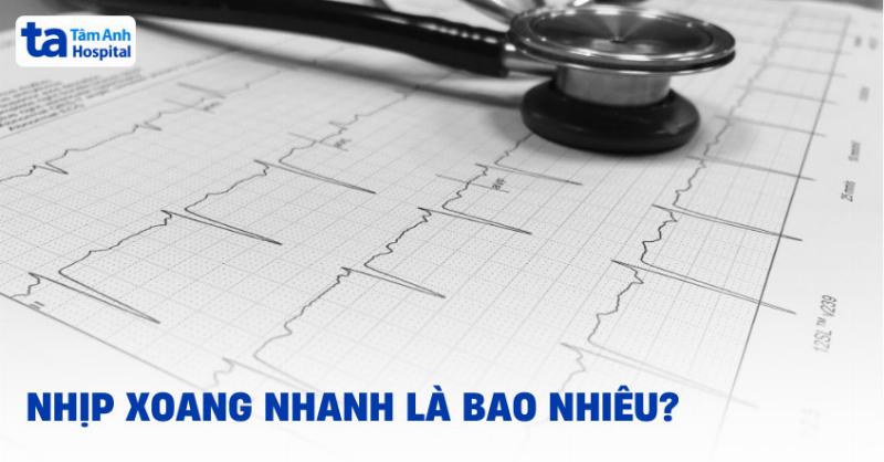 Nhịp Nhanh Xoang Là Gì?