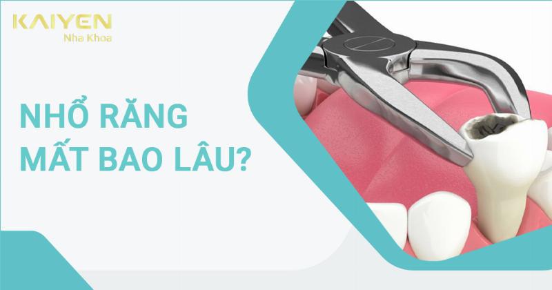 Nhổ Răng Mất Bao Lâu? Giải Đáp Chi Tiết Từ A-Z