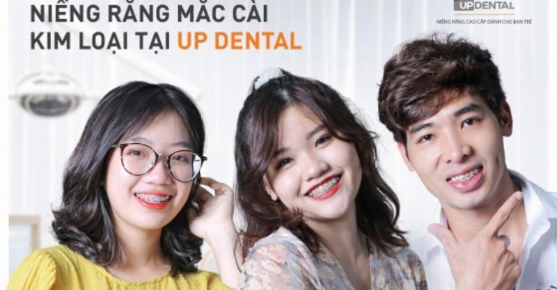 Bảng giá niềng mắc cài kim loại