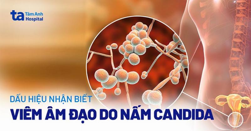 Phòng ngừa nhiễm nấm âm đạo