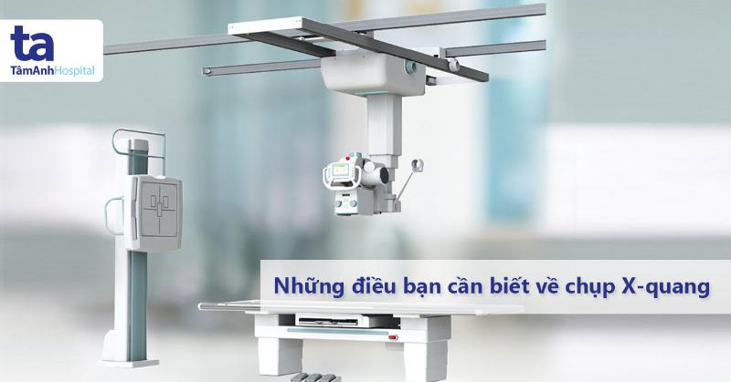 Quy Trình Chụp X-Quang Xương Khớp Đơn Giản