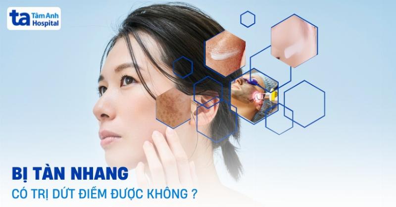 Tàn nhang có tự hết không