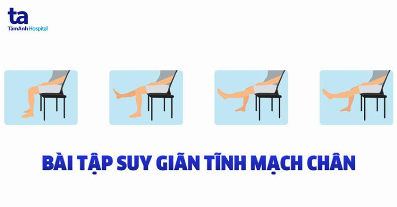 Tập thể dục phòng ngừa mỏi chân