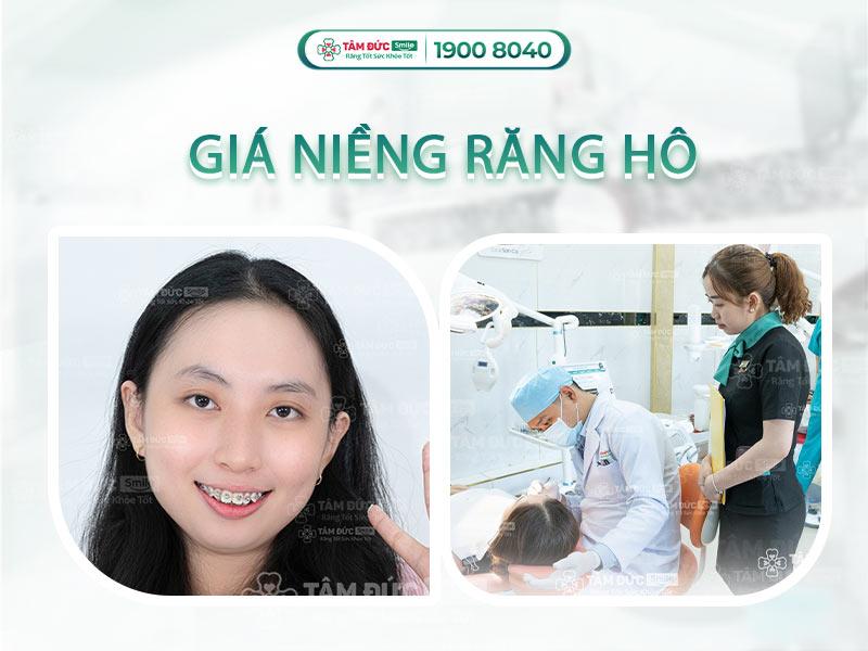 Ảnh hưởng của tình trạng răng miệng đến chi phí niềng răng