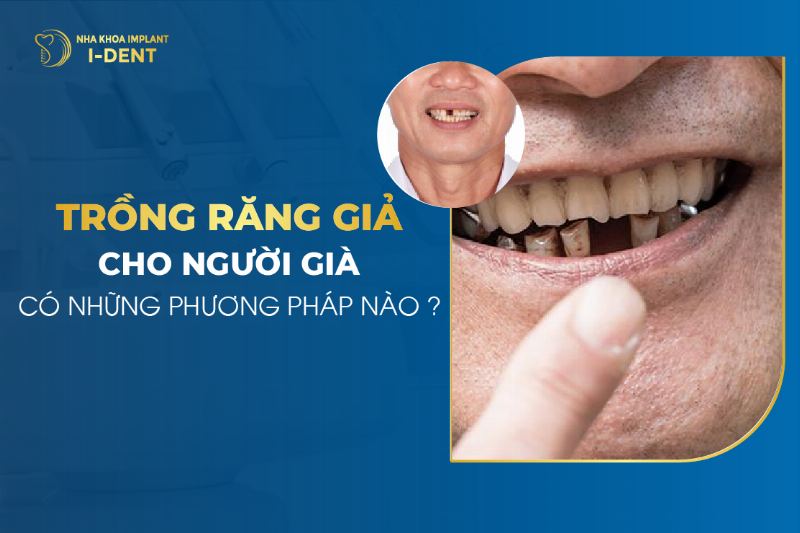 Ảnh hưởng của tình trạng răng miệng đến chi phí trồng răng