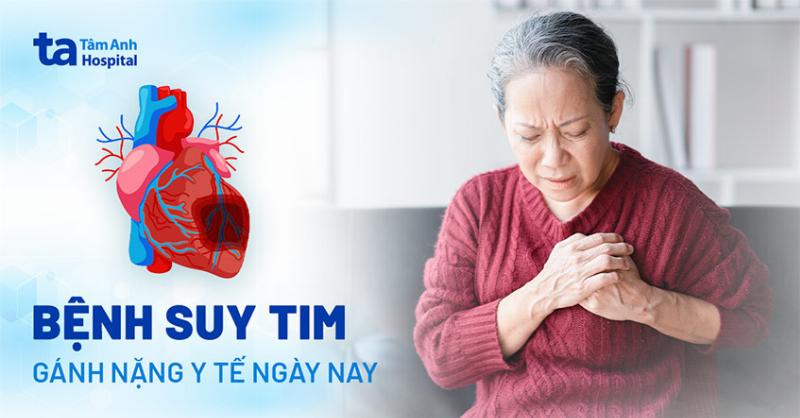 Các triệu chứng của suy tim. Hình ảnh minh họa các triệu chứng thường gặp của suy tim như khó thở, mệt mỏi, phù chân.