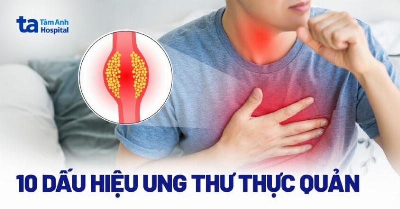 Triệu chứng Ung Thư Thực Quản: Đau Khi Nuốt