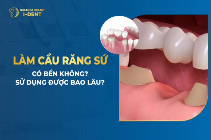 Trồng răng giả cầu răng sứ