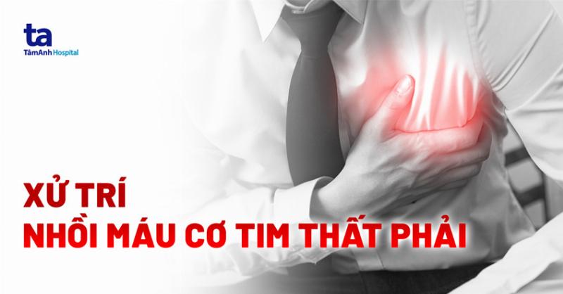 Nhồi Máu Cơ Tim Sống Được Bao Lâu?