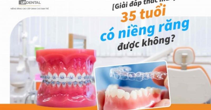 Bác sĩ tư vấn niềng răng 35 tuổi