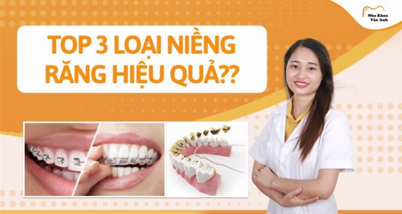 Niềng Răng Hô Giá Bao Nhiêu?
