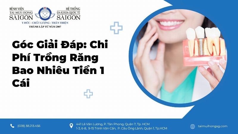 Chi phí trồng răng