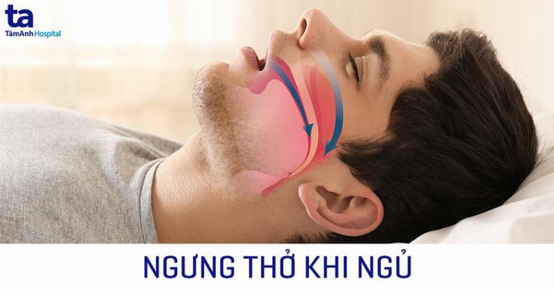 Gặp bác sĩ khi nghi ngờ ngưng thở khi ngủ