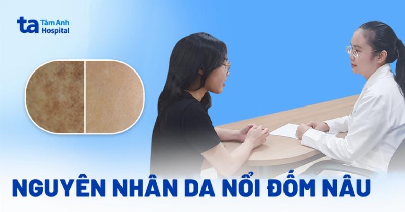 Khi nào cần khám bác sĩ da liễu khi da nổi đốm nâu
