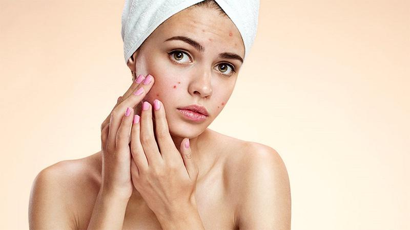 Lưu Ý Serum Vitamin C Da Dầu