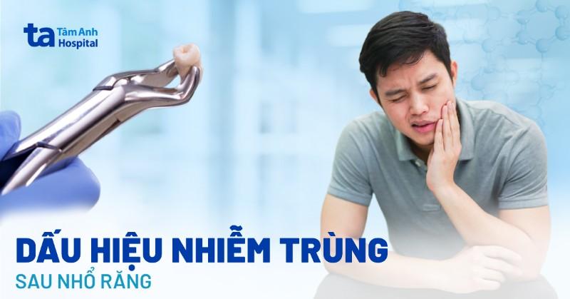 Nhổ chân răng sâu nhiễm trùng nặng
