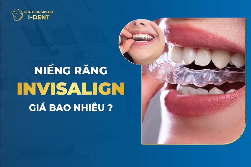 Niềng răng trong suốt Invisalign