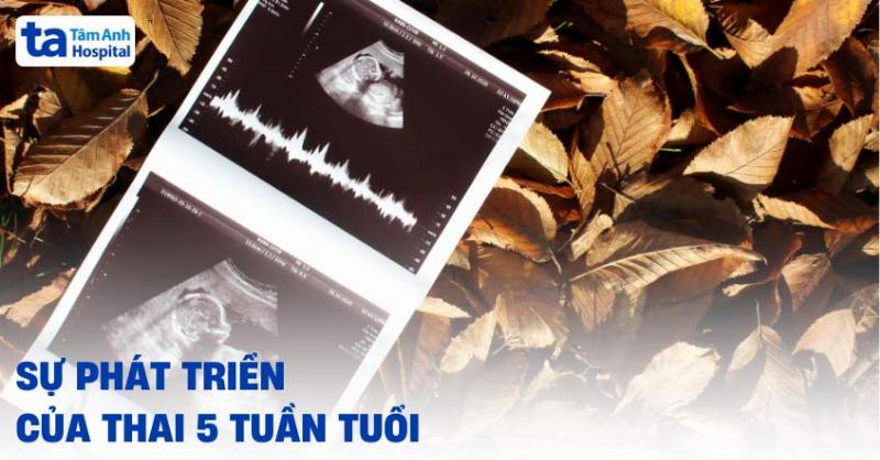 Sự phát triển của tim thai ở tuần thứ 5