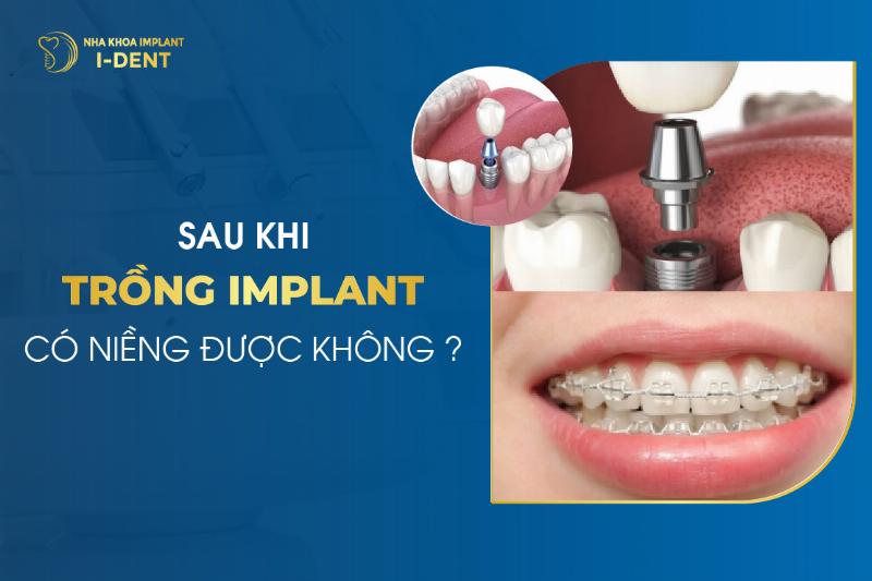 Trồng răng implant có niềng được không?