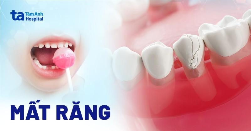 Ảnh hưởng của tình trạng sức khỏe răng miệng đến việc trồng răng nhai