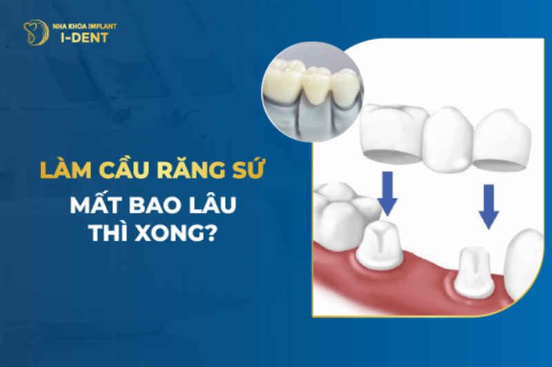 Trồng răng sứ phụ thuộc vào loại sứ