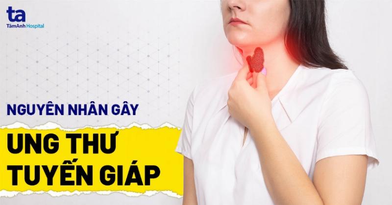 Hiểu Rõ Về Bệnh Ung Thư Tuyến Giáp