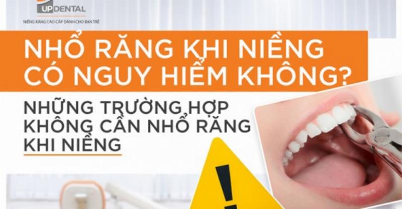Các loại răng thường nhổ khi niềng