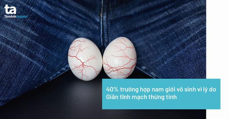Giãn Tĩnh Mạch Thừng Tinh Là Gì? Minh Họa Cấu Trúc Giải Phẫu