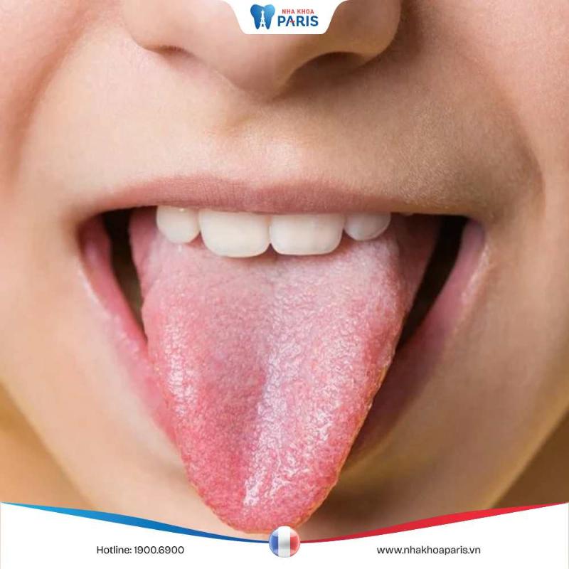 Hình ảnh lưỡi bình thường người lớn