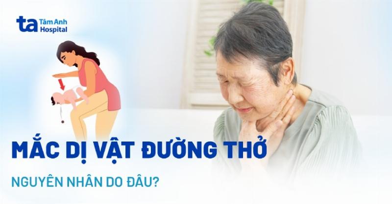 Dị Vật Đường Thở Ở Người Lớn: Nguyên Nhân, Triệu Chứng Và Cách Xử Lý
