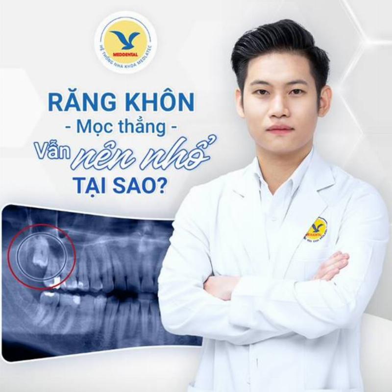 Ảnh minh họa quy trình nhổ răng khôn