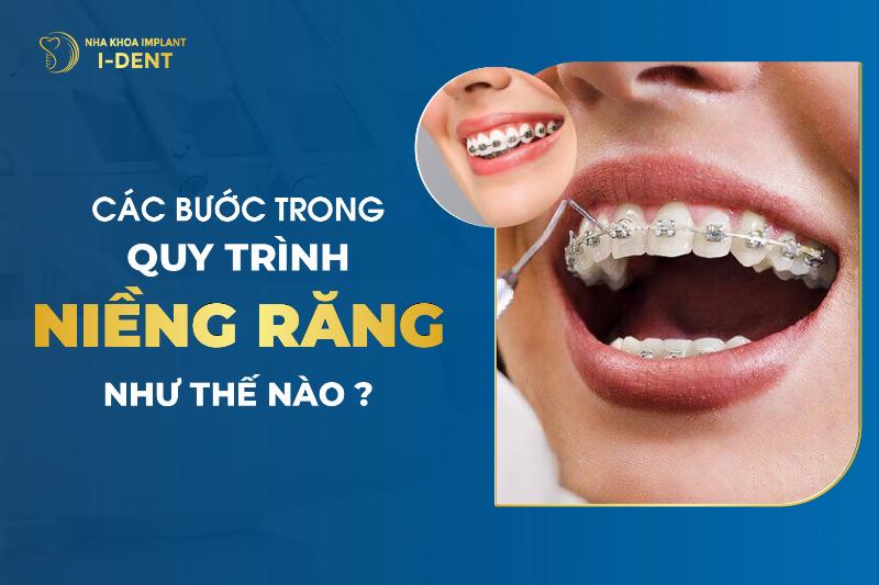 Quy Trình Niềng Răng