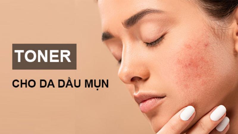 Toner Cho Da Dầu Mụn Quan Trọng
