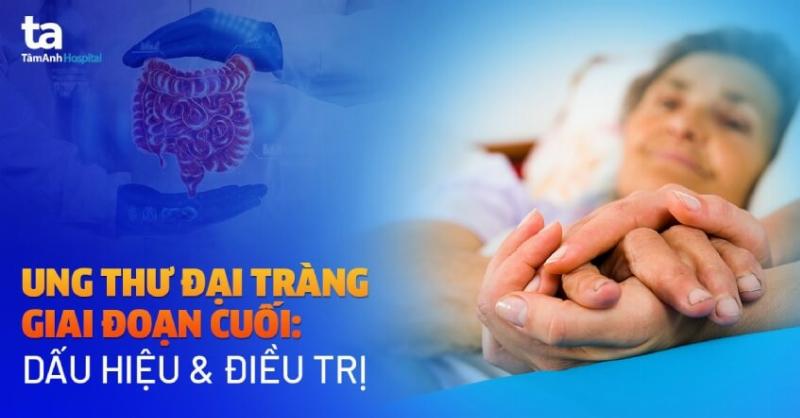 Ung Thư Đại Tràng Giai Đoạn Cuối: Giải Pháp Điều Trị