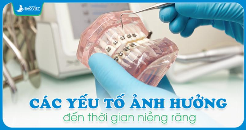 Yếu Tố Ảnh Hưởng Thời Gian Niềng Răng