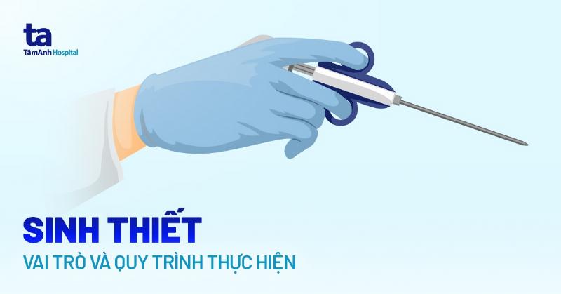 Sinh thiết bao lâu có kết quả? Chờ đợi và Hiểu Rõ Quy Trình