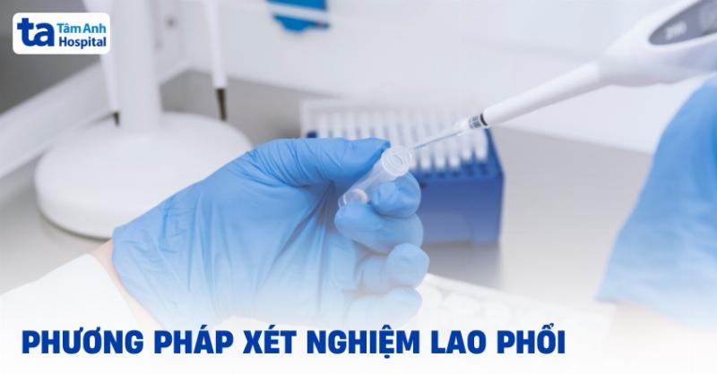 Hình ảnh bác sĩ đang thăm khám cho bệnh nhân có triệu chứng lao phổi, thể hiện quy trình chẩn đoán và chăm sóc y tế ban đầu