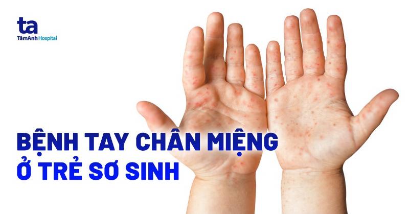 Hình ảnh bác sĩ nhi khoa đang thăm khám cẩn thận cho một em bé sơ sinh bị sốt