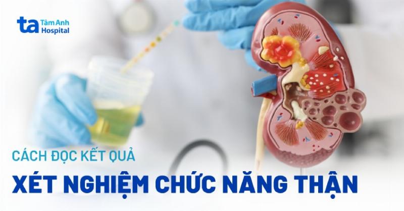 Hình ảnh bảng kết quả các chỉ số xét nghiệm máu và nước tiểu