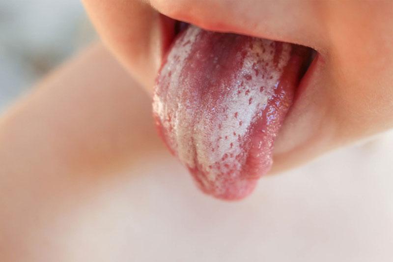 Bé Sơ Sinh Thở Khò Khè: Lo Lắng Hay Bình Thường & Chăm Sóc Toàn Diện