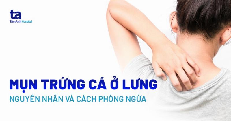 Hình Ảnh Mụn Trứng Cá: Điều Gì Liên Quan Đến Răng Miệng?