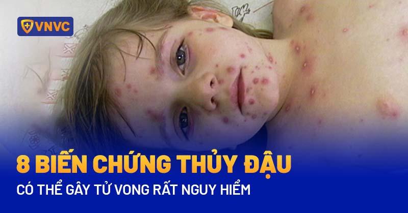 Các biến chứng nghiêm trọng có thể xảy ra nếu bội nhiễm da không được điều trị kịp thời và đúng cách.