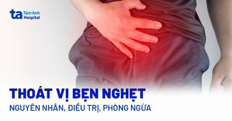 Thoát vị bẹn có nguy hiểm không? Hiểu rõ nguy cơ và cách xử lý