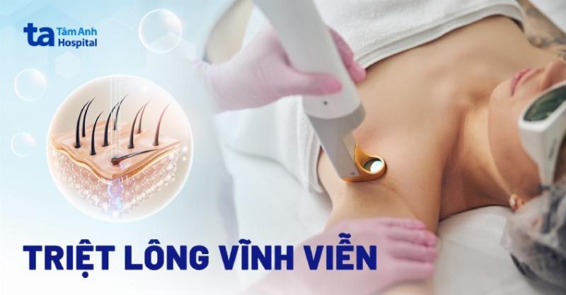 Triệt Lông Vùng Kín Có Tốt Không? Góc Nhìn Từ Chuyên Gia