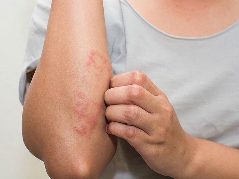 Hình ảnh minh họa các biện pháp phòng ngừa viêm da tiếp xúc dị ứng như đeo găng tay, đọc nhãn sản phẩm và tránh cây độc.