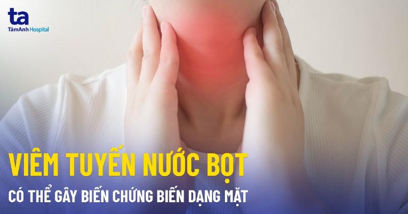 U Tuyến Nước Bọt Dưới Hàm: Những Điều Cần Biết Để Bảo Vệ Sức Khỏe