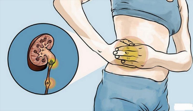 Đau Nhói Bụng Bên Trái Ngang Rốn: Dấu Hiệu Nào Cần Chú Ý Ngay?