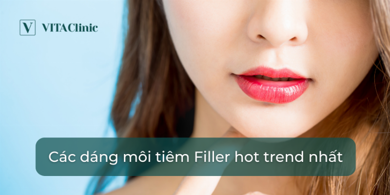Bật Mí Những Dáng Môi Tiêm Filler Đẹp Chuẩn Tỉ Lệ, Hot Nhất 2024