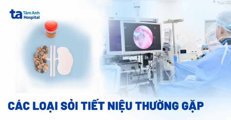 Hình minh họa các loại sỏi thận khác nhau về hình dạng, màu sắc và kích thước (canxi oxalat, axit uric, struvite, cystine)